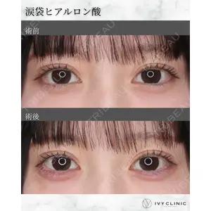 千葉美容外科アイビークリニックの症例