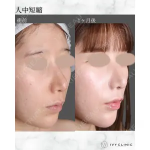 千葉美容外科アイビークリニックの症例