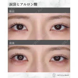 千葉美容外科アイビークリニックの症例
