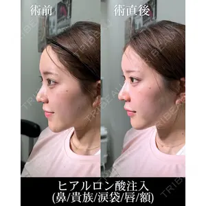 HAAB×DREAM BEAUTY CLINIC 大阪梅田院 錦 実奈医師の症例