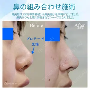 聖心美容クリニック 六本木院 伊藤 康平医師の症例