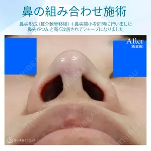 聖心美容クリニック 六本木院 伊藤 康平医師の症例