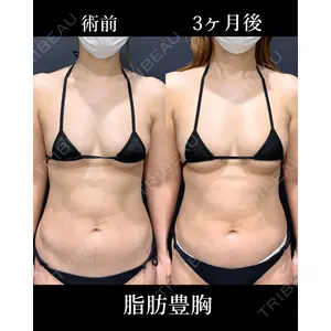 HAAB×DREAM BEAUTY CLINIC 東京本院 吉岡 修一医師の症例