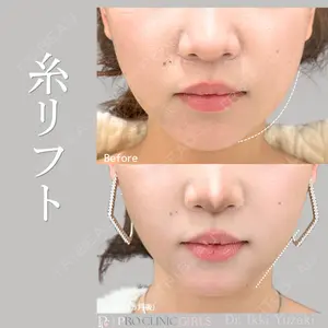 PRO CLINIC プロクリニック 銀座院 柚﨑 一輝医師の症例