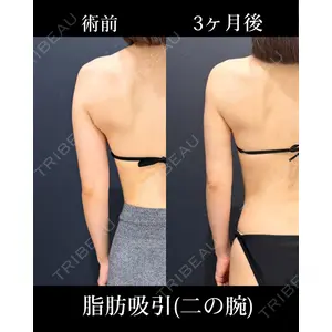 HAAB×DREAM BEAUTY CLINIC 東京本院 吉岡 修一医師の症例