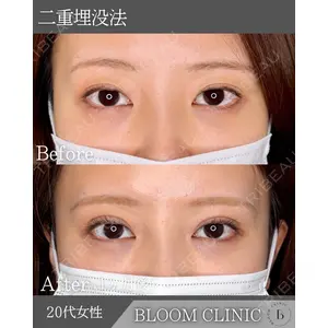 ブルームクリニック（BLOOM CLINIC）の症例