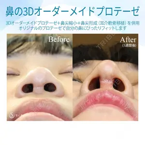 聖心美容クリニック 六本木院 伊藤 康平医師の症例