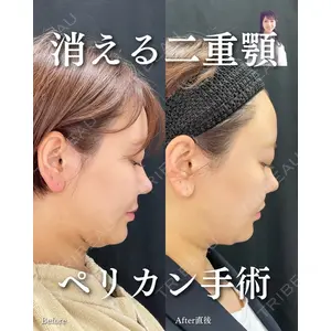 ルラ美容クリニック 渋谷本院 住友 沙織医師の症例
