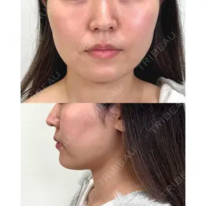 Moon Beauty Clinic 渡邉 正士医師の症例