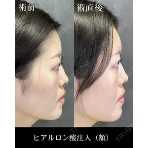HAAB CLINIC 福岡院 米谷 拓朗医師の症例