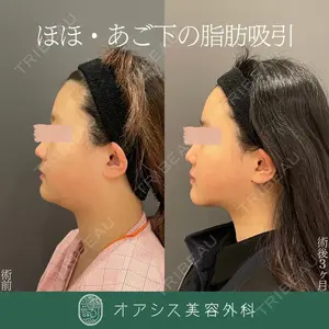 オアシス美容外科 遠藤 剛史医師の症例