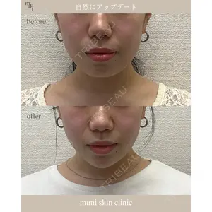 muni skin clinic 高麗 惠理医師の症例