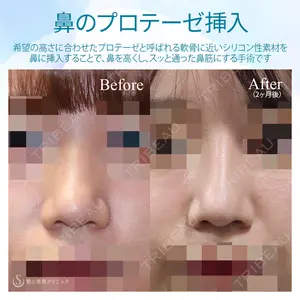 聖心美容クリニック 銀座院 牧野 陽二郎医師の症例