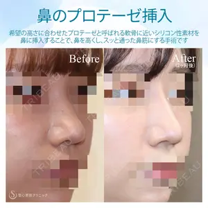 聖心美容クリニック 銀座院 牧野 陽二郎医師の症例