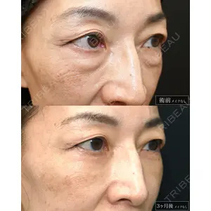 湘南美容クリニック 名古屋駅本院 高川 裕也医師の症例