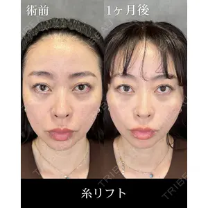 HAAB CLINIC 福岡院 北村 可恋医師の症例