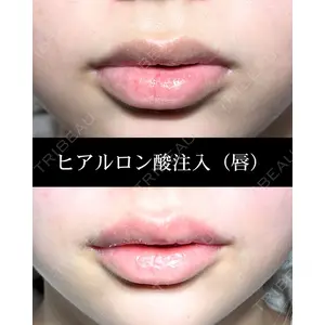 HAAB CLINIC 福岡院 北村 可恋医師の症例