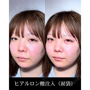 HAAB CLINIC 福岡院 北村 可恋医師の症例