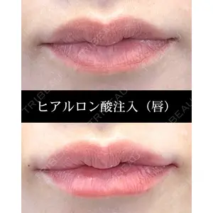HAAB CLINIC 福岡院 米谷 拓朗医師の症例