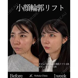 ネビュラクリニック 東京錦糸町院 岩切 琢磨医師の症例