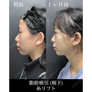 HAAB CLINIC 池袋院 野田 裕太郎　医師の症例