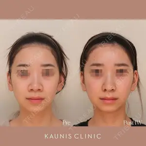 KAUNIS CLINIC（カウニスクリニック）の症例