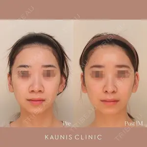 KAUNIS CLINIC（カウニスクリニック）の症例