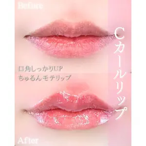 ルラ美容クリニック 大阪本院の症例