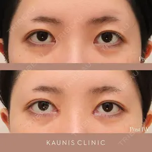 KAUNIS CLINIC（カウニスクリニック）の症例