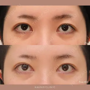 KAUNIS CLINIC（カウニスクリニック）の症例