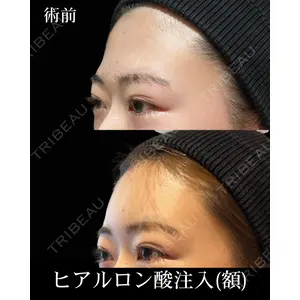 HAAB×DREAM BEAUTY CLINIC 東京本院 佐野 圭医師の症例