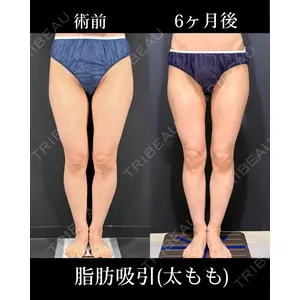 HAAB×DREAM BEAUTY CLINIC 東京本院 吉岡 修一医師の症例