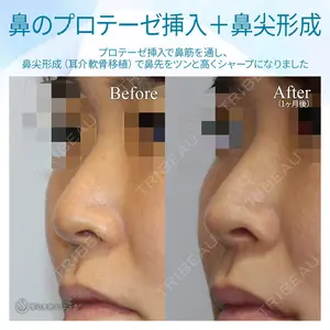 聖心美容クリニック 六本木院 菱田 健作医師の症例