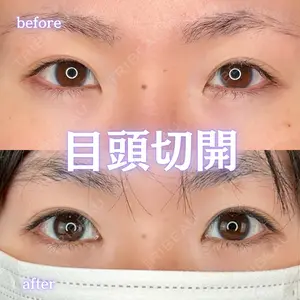 ルラ美容クリニック 新宿院 陶 美梨医師の症例