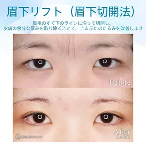 聖心美容クリニック 六本木院 菱田 健作医師の症例