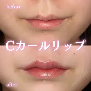 ルラ美容クリニック 新宿院 陶 美梨医師の症例