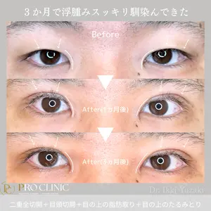 PRO CLINIC プロクリニック 銀座院 柚﨑 一輝医師の症例