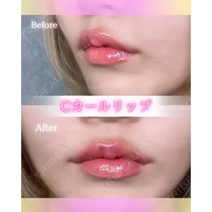 ルラ美容クリニック 岡山院の症例