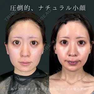 Wing clinic 豊中駅前院 速水 翼医師の症例