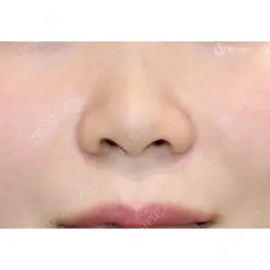 聖心美容クリニック 六本木院 伊藤 康平医師の症例
