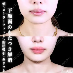 アリエル美容クリニック 郡山院 安齋 誠基医師の症例
