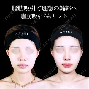 アリエル美容クリニック 郡山院 安齋 誠基医師の症例