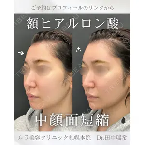 ルラ美容クリニック 札幌本院 田中 瑞希医師の症例