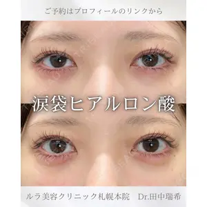 ルラ美容クリニック 札幌本院 田中 瑞希医師の症例