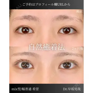 ルラ美容クリニック 札幌本院 早坂 亮哉医師の症例