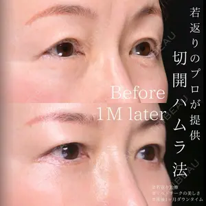 Zetith Beauty Clinic 大阪心斎橋院 楠本 拓哉医師の症例
