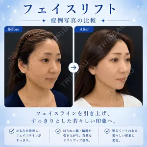 ルラ美容クリニック 渋谷本院 住友 沙織医師の症例