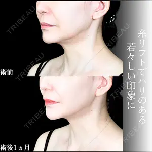 アリエル美容クリニック 大宮院 江郷隼一郎医師の症例