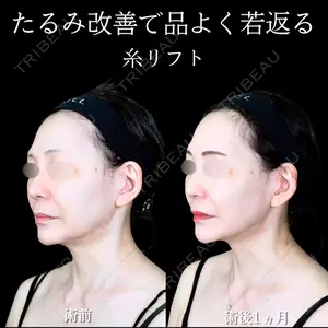 アリエル美容クリニック 大宮院 江郷隼一郎医師の症例