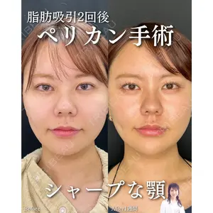 ルラ美容クリニック 渋谷本院 住友 沙織医師の症例